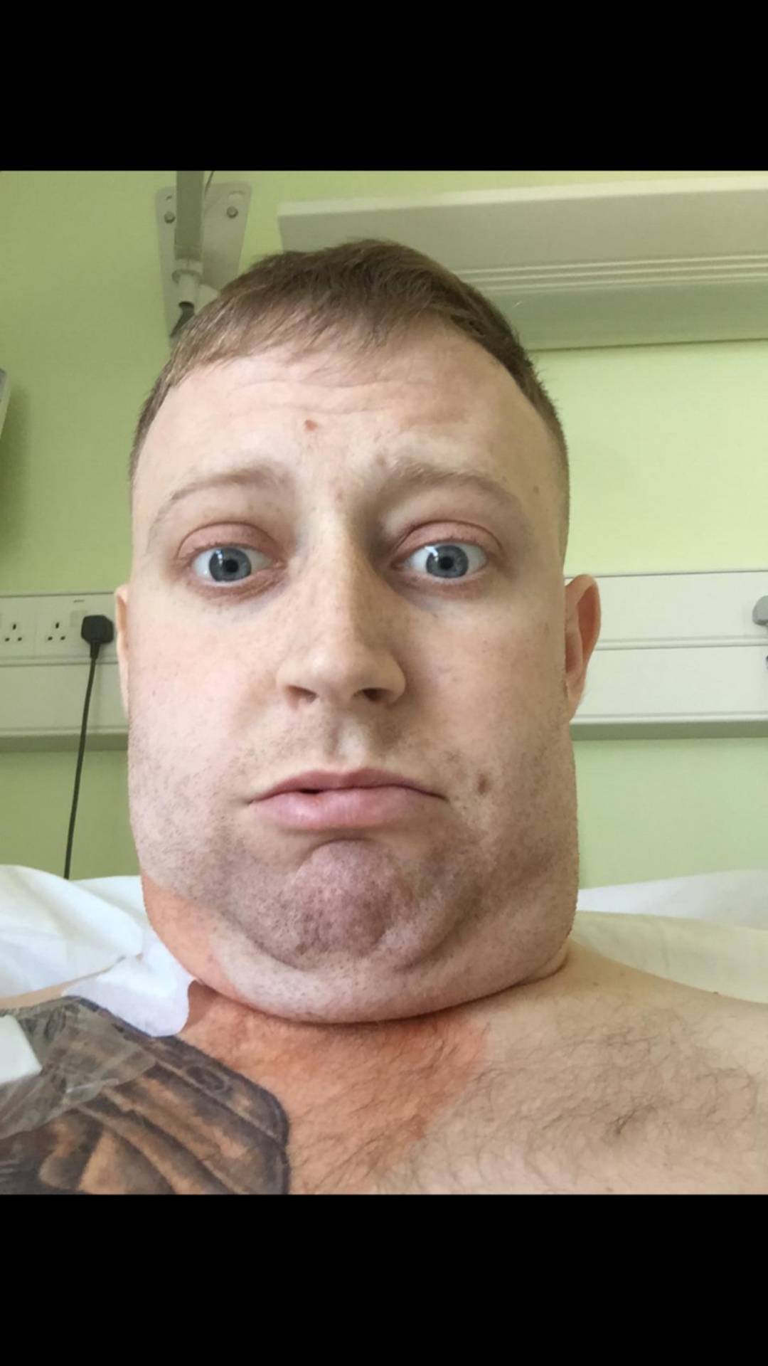 Jon Mozley hospital recovery journey