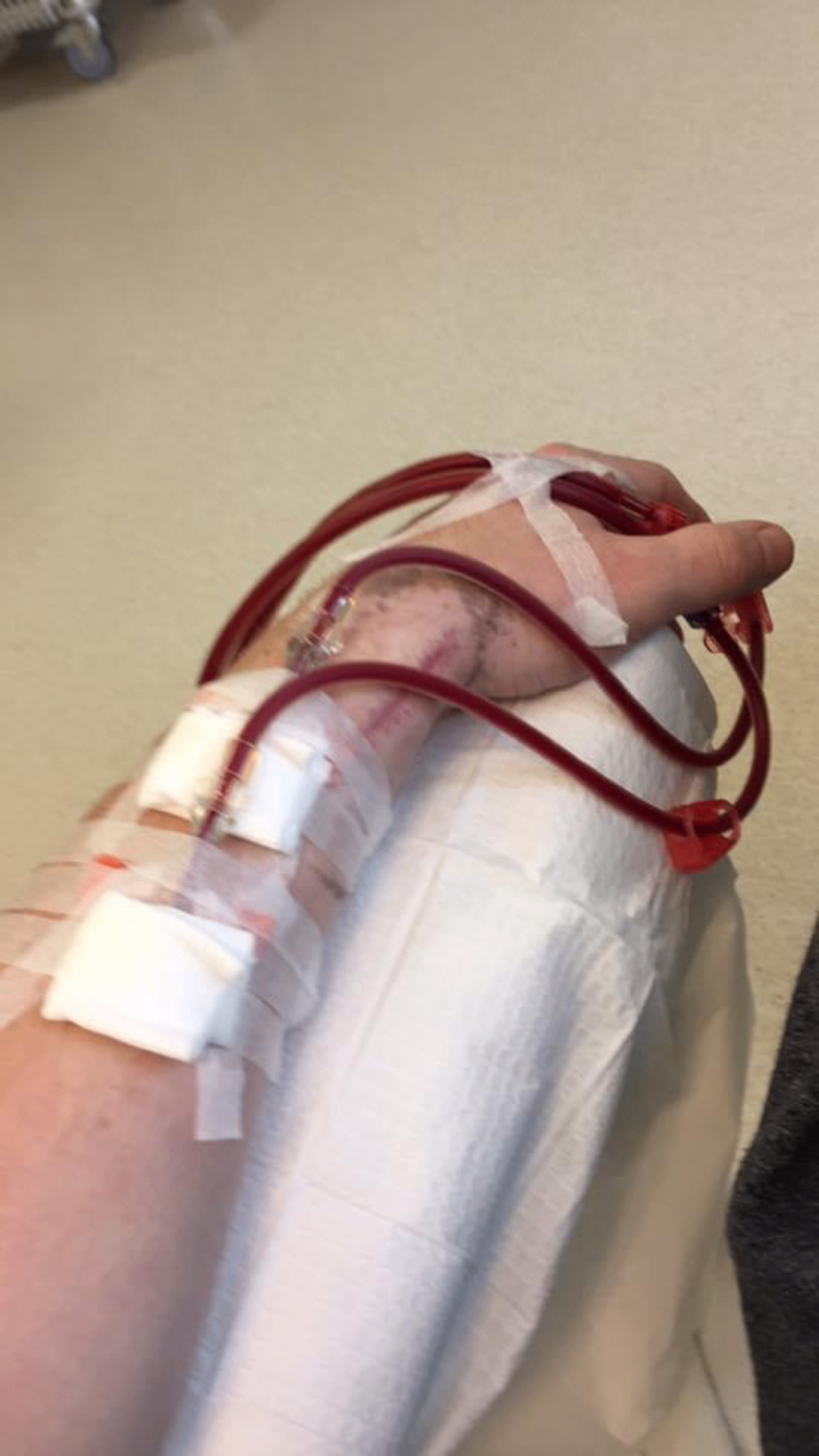 Jon Mozley hospital recovery journey