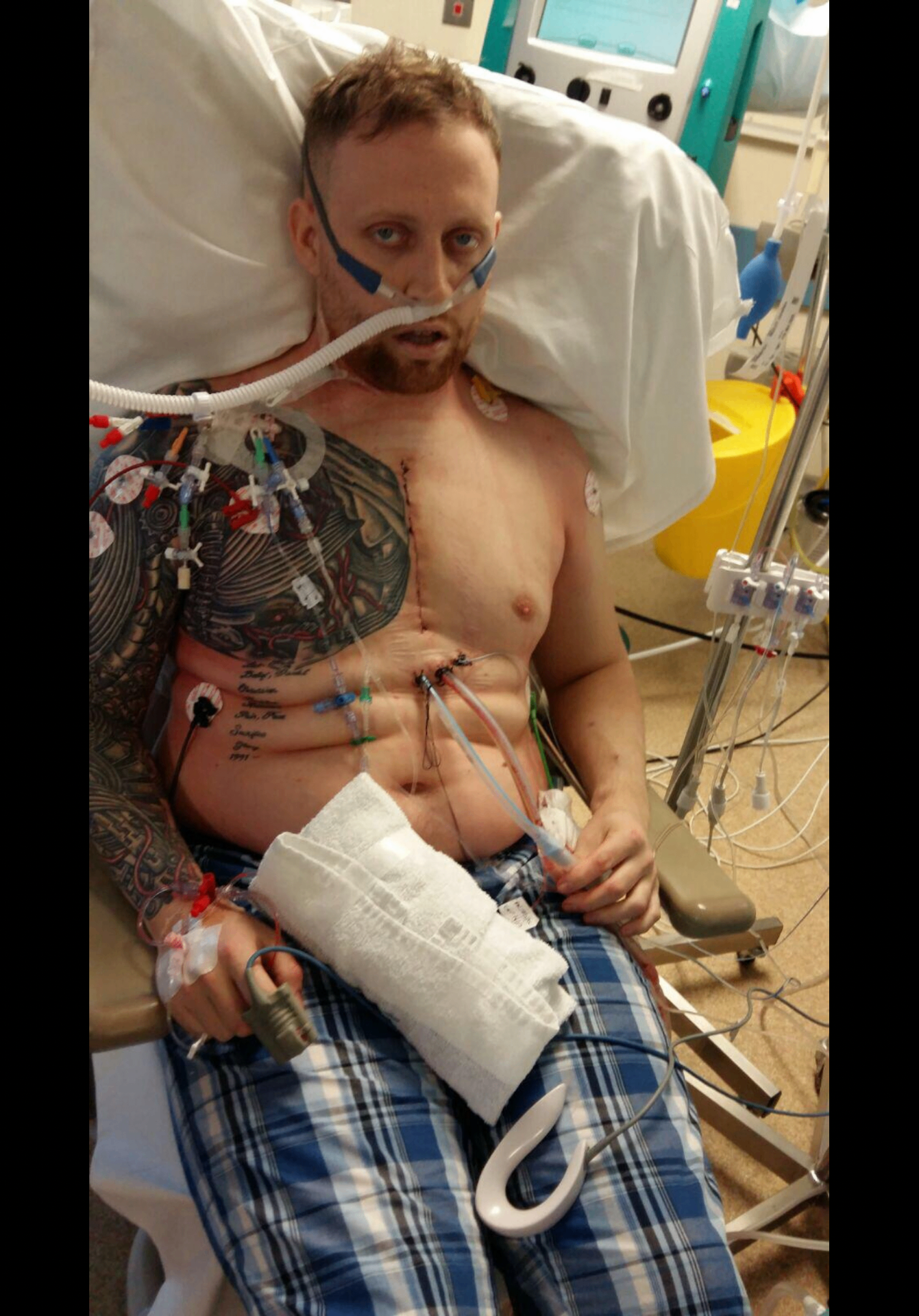 Jon Mozley hospital recovery journey